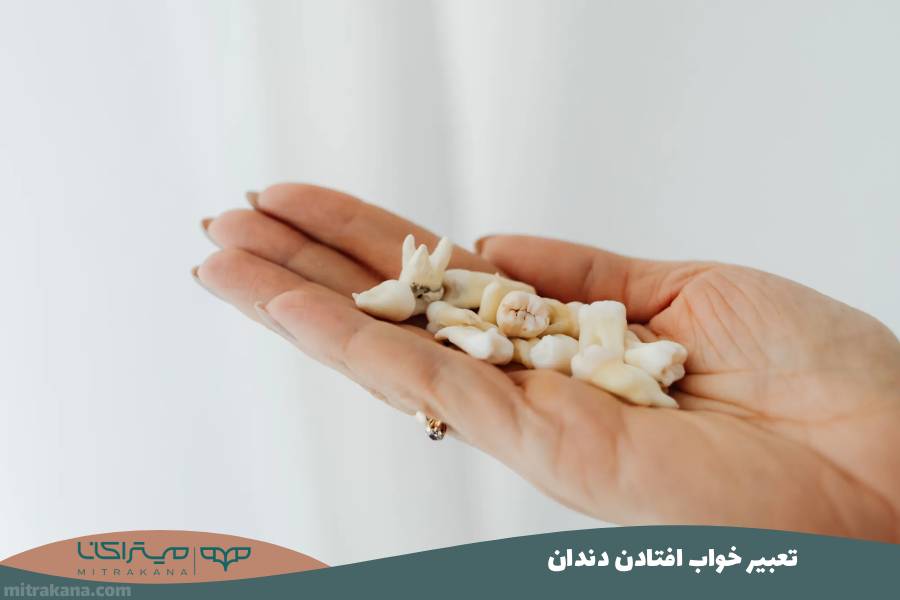 تعبیر خواب افتادن دندان