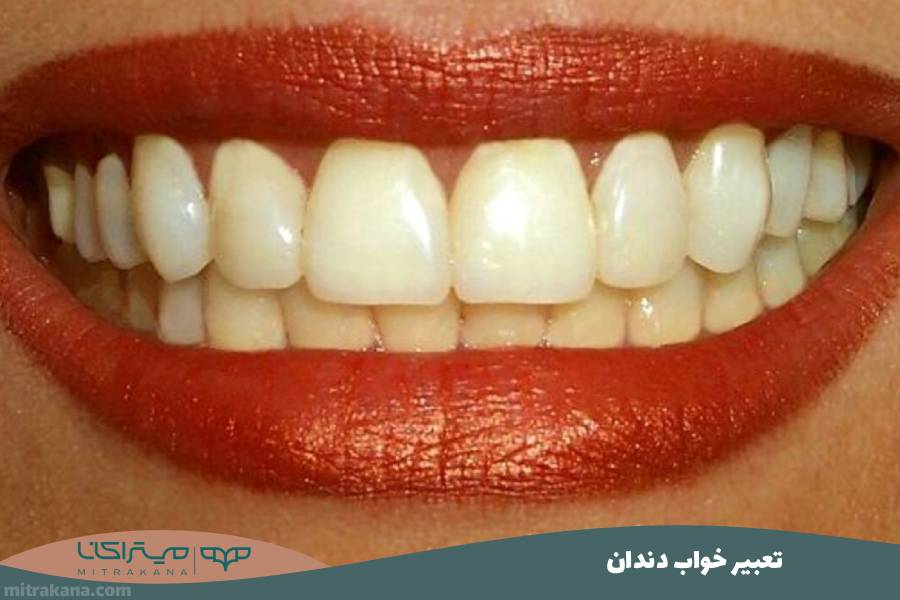 تعبیر خواب دندان